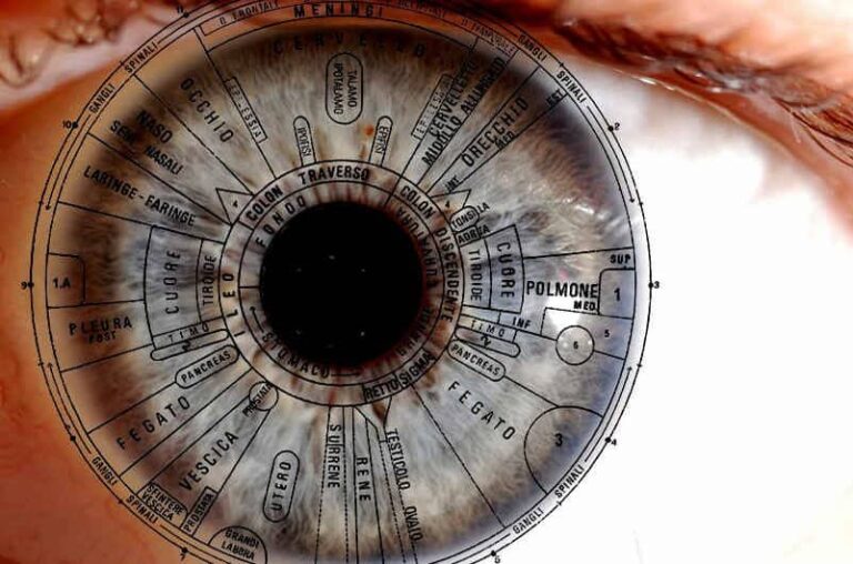 Iridologia