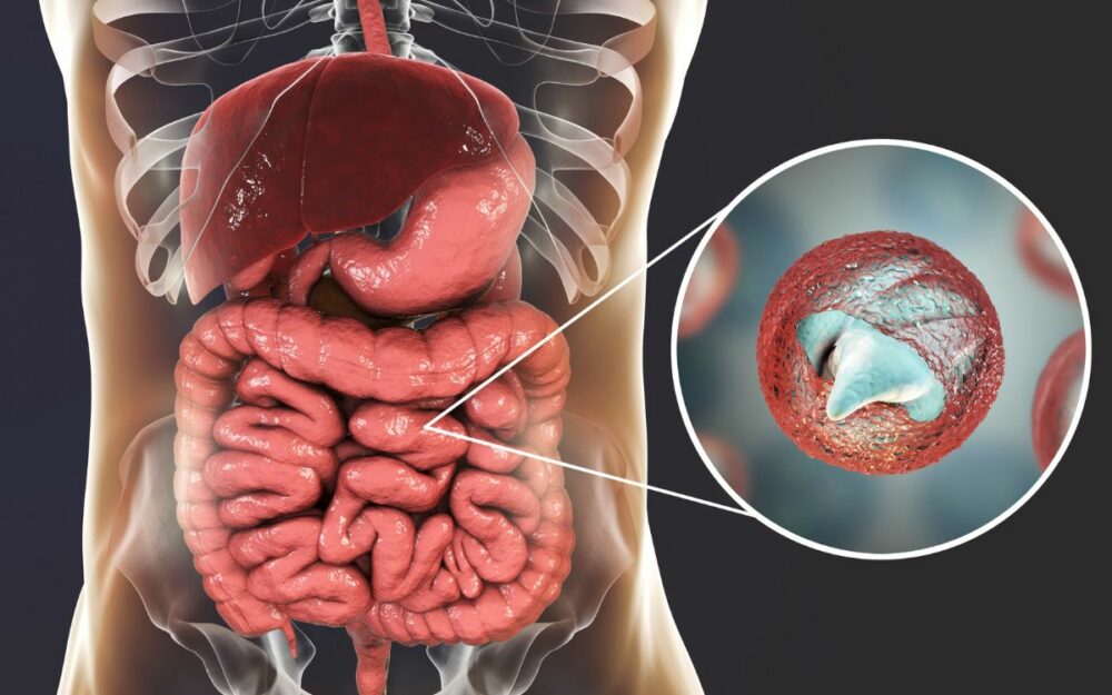 Parassiti intestinali rimedi